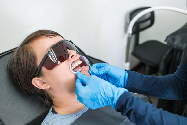 Best Knocked-Out Tooth (Avulsed Tooth) Treatment in Oxnard, CA